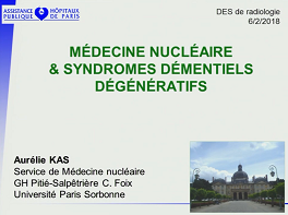 Perfusion et neurotransmission cérébrale