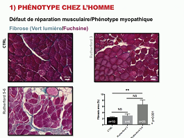 Perfusion et réparation tissulaire post-ischémie chronique dans le diabète