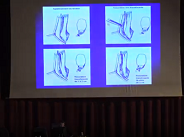 Physiopathologie des instabilités de la cheville