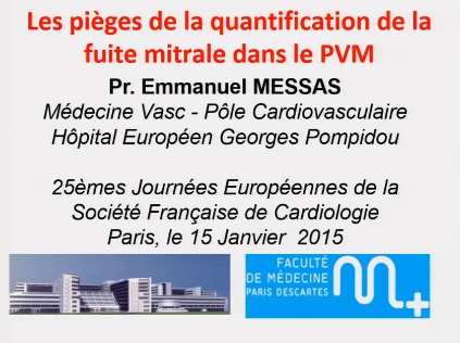 Pieges dans la quantification
