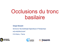 Pièges en neurologie-Occlusion du tronc basilaire