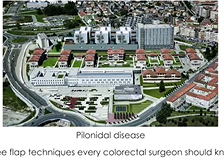 Pilonidal disease. Three flap procedures every colorrectal surgeon should know Pilonidal disease. Three flap procedures every colorrectal surgeon should know