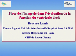 Place de l'imagerie cardiaque dans l'évaluation de la fonction ventriculaire droite Place de l'imagerie cardiaque dans l'évaluation de la fonction ventriculaire droite