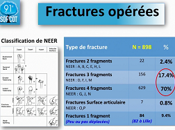 Place des Prothèses Totales dÉpaule Inversées dans les Fractures Récentes de lHumérus Proximal Place des Prothèses Totales dÉpaule Inversées dans les Fractures Récentes de lHumérus Proximal