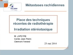 Place des techniques récentes de radiothérapie - Irradiation stéréotaxique