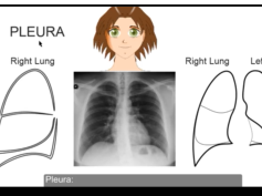 Pleura and pleural cavity- and associated conditions Pleura and pleural cavity- and associated conditions