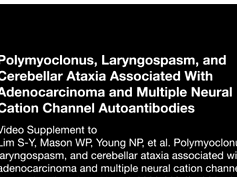 Polymyoclonus, Laryngospasm, and Cerebellar Ataxia Associated With Adenocarcinoma and Multiple Neura-2 Polymyoclonus, Laryngospasm, and Cerebellar Ataxia Associated With Adenocarcinoma and Multiple Neura-2