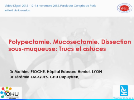 Polypectomie, mucosectomie et dissection sous-muqueuse : trucs et astuces Polypectomie, mucosectomie et dissection sous-muqueuse : trucs et astuces