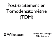 Post traitements en tomodensitométrie