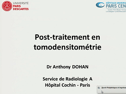 Post traitements en tomodensitométrie Post traitements en tomodensitométrie