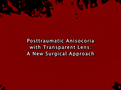 Post-traumatic Anisocoria With Transparent Lens: A New Surgical Approach Post-traumatic Anisocoria With Transparent Lens: A New Surgical Approach