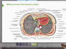 Posterior Mediastinum - Anatomy Posterior Mediastinum - Anatomy