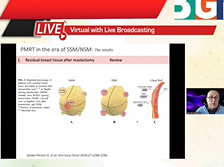 Postmastectomy radiation therapy in the era of SSM NSM with immediate breast Postmastectomy radiation therapy in the era of SSM NSM with immediate breast