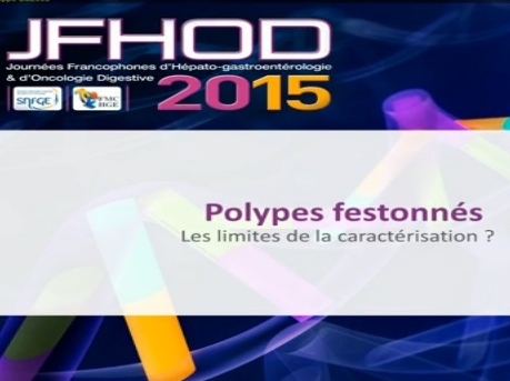 Pourquoi et comment caractériser les polypes colorectaux ? (1)