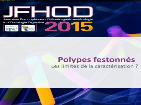 Pourquoi et comment caractériser les polypes colorectaux ? (2)