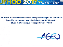 Poursuite du trastuzumab au-delà de la première ligne de traitement des adénocarcinomes avancés de l'estomac HER2 positif : étude multicentrique rétrospective de l'AGEO