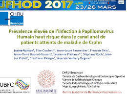 Prévalence élevée de l'infection à Papillomavirus haut risque dans le canal anal de patients atteints de maladie de Crohn