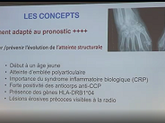 Prévenir les complications de la maladie et des traitements (1/4)
