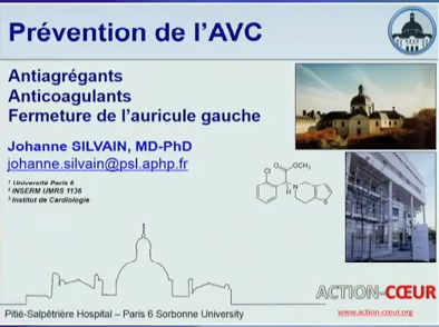 Prévention de l’accident vasculaire cérébral : anti-agrégants plaquettaires, anti-coagulants, fermeture de l’auricule gauche Prévention de l’accident vasculaire cérébral : anti-agrégants plaquettaires, anti-coagulants, fermeture de l’auricule gauche