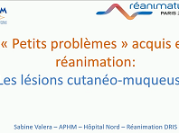 Prévention et traitements des "petits" problèmes en réanimation