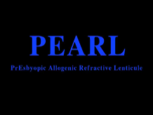 Presbyopic Allogenic Refractive Lenticule Presbyopic Allogenic Refractive Lenticule