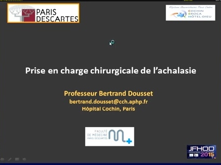 Prise en charge de l’achalasie - Chirurgie