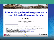 Prise en charge des AVC sous anticoagulants oraux