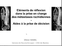 Prise en charge des métastases rachidiennes (3/5) - Eléments de réflexion dans la prise en charge des métastases rachidiennes