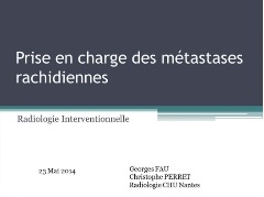Prise en charge des métastases rachidiennes (4/5) - Approche récente