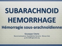 Prise en charge des pathologies cérébro-vasculaires - Hémorragies sous-arachnoidiennes Prise en charge des pathologies cérébro-vasculaires - Hémorragies sous-arachnoidiennes