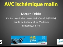 Prise en charge des pathologies cérébrovasculaires - AVC ischémique malin