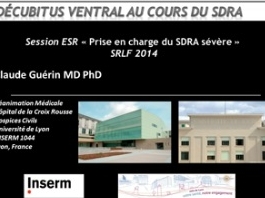 Prise en charge du SDRA sévère - Decubitus ventral au cours du SDRA