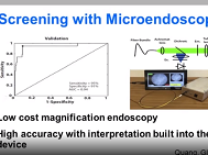 Progress in the Treatment of Squamous Esophageal Dysplasia
