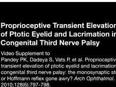 Proprioceptive Transient Elevation of Ptotic Eyelid and Lacrimation in Congenital Third Nerve Palsy Proprioceptive Transient Elevation of Ptotic Eyelid and Lacrimation in Congenital Third Nerve Palsy