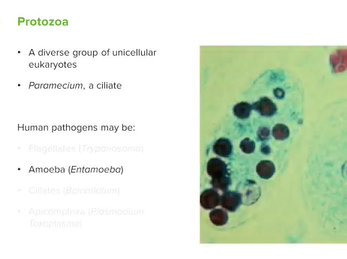 Protozoa: Definition & Types of Microbes _ Microbiology _ Lecturio