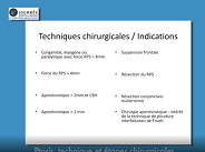 Ptosis, technique et étapes chirurgicales