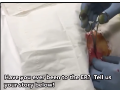 Pus-Pocket - Emergency Room Abscess