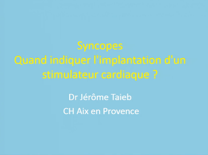 Quand indiquer l'implantation d'un stimulateur cardiaque