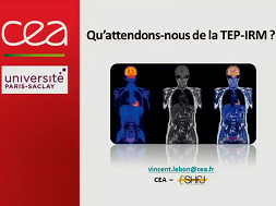 Qu'attendons-nous de la TEP-IRM ? Qu'attendons-nous de la TEP-IRM ?