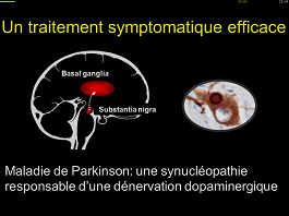 Que faire au stade initial des fluctuations ?