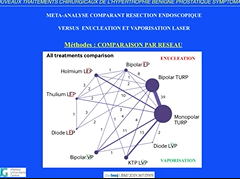 Quel traitement pour une prostate hypertrophique ? - Pr Iselin