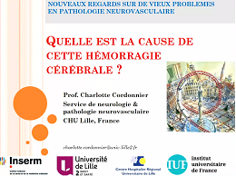 Quelle est la cause de cette hémorragie cérébrale ? Quelle est la cause de cette hémorragie cérébrale ?