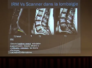 Quelle imagerie pour le mal de dos ?