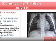 Quelle prise en charge pour les enfants d'un parent souffrant d'une tuberculose ? Quelle prise en charge pour les enfants d'un parent souffrant d'une tuberculose ?