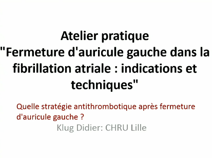 Quelle stratégie antithrombotique après fermeture d'auricule