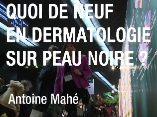 Quoi de neuf en dermatologie sur peau noire ?
