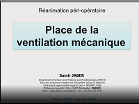 Réanimation péri-opératoire