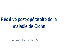 Récidive post-opératoire de la maladie de Crohn