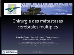 Rôle de la chirurgie chez les patients atteints de métastases