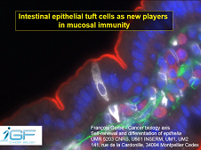 Rôle des cellules tuft dans la protection de la muqueuse intestinale